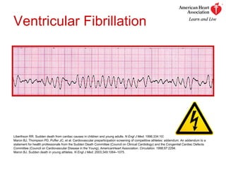 Ventricular Fibrillation Liberthson RR. Sudden death from cardiac causes in children and young adults.  N Engl J Med . 1996;334:1039–1044. Maron BJ, Thompson PD, Puffer JC, et al. Cardiovascular preparticipation screening of competitive athletes: addendum. An addendum to a statement for health professionals from the Sudden Death Committee (Council on Clinical Cardiology) and the Congenital Cardiac Defects Committee (Council on Cardiovascular Disease in the Young), AmericanHeart Association.  Circulation . 1998;97:2294. Maron BJ. Sudden death in young athletes.  N Engl J Med . 2003;349:1064–1075. 