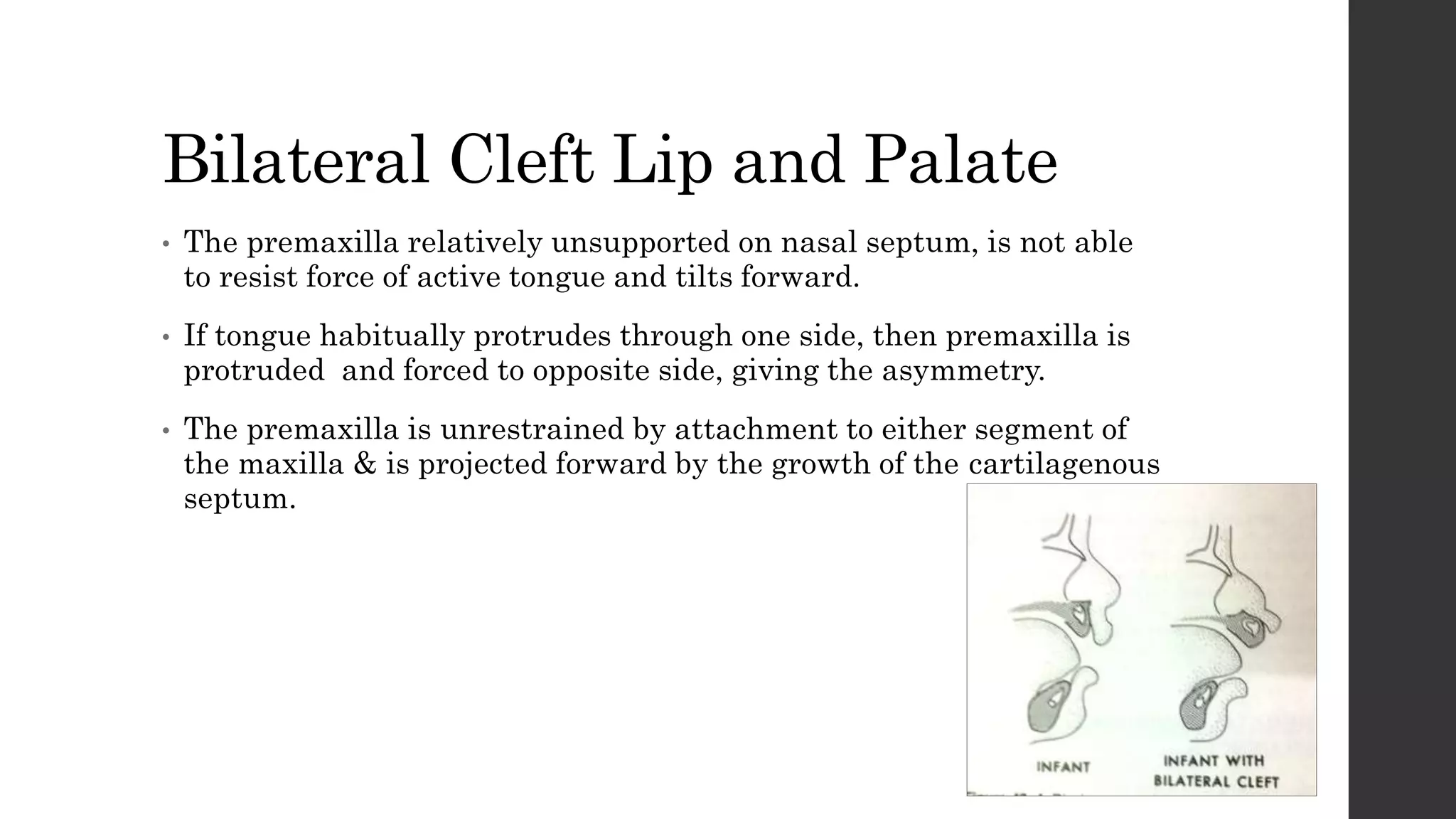 Naso alveolar molding treatment protocol in patients with cleft | PPTX