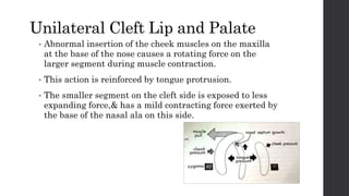 Naso alveolar molding treatment protocol in patients with cleft | PPTX