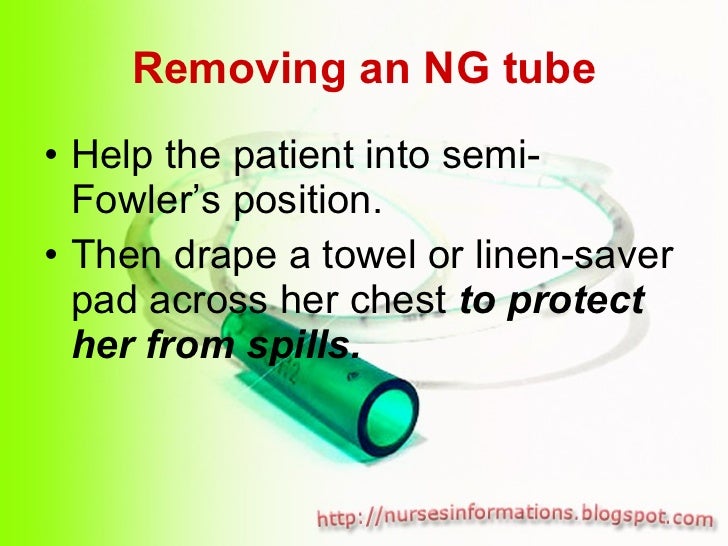 Nasogastric Tube (NGT) insertion and removal