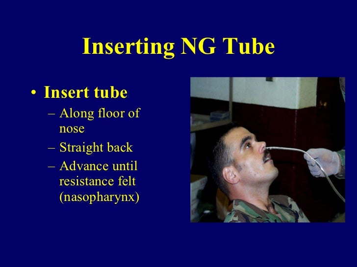 Nasogastric intubation