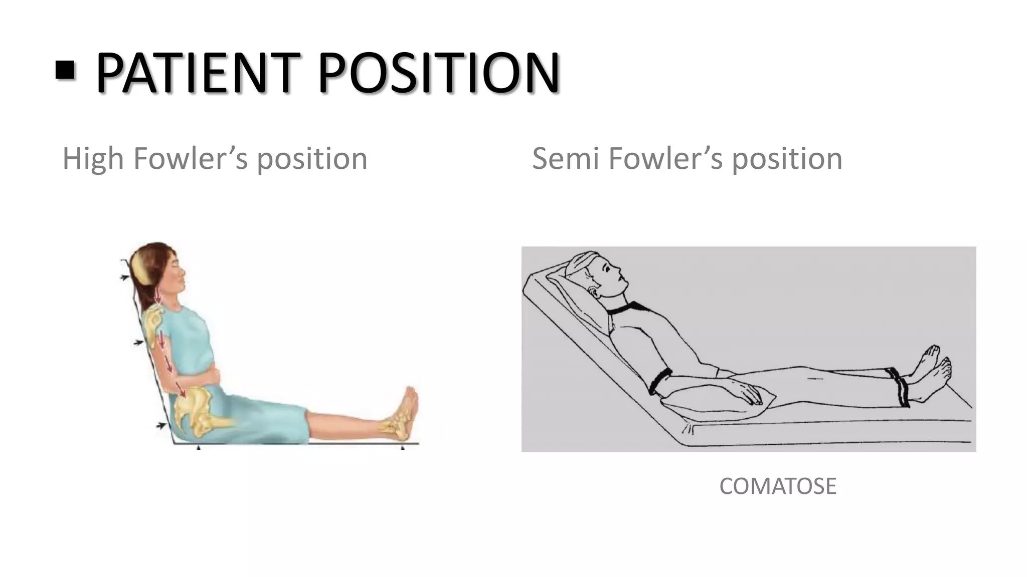 Nasogastric tube | PDF