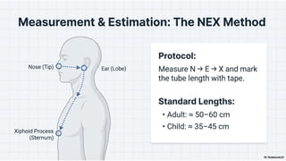 Nasogastric_Tube_Clinical_Essentials.pptx