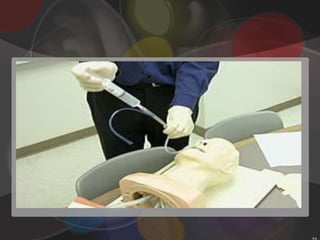 Preparation of equipmentInspect the NG tube for defects, such as rough edges or partially closed lumens.