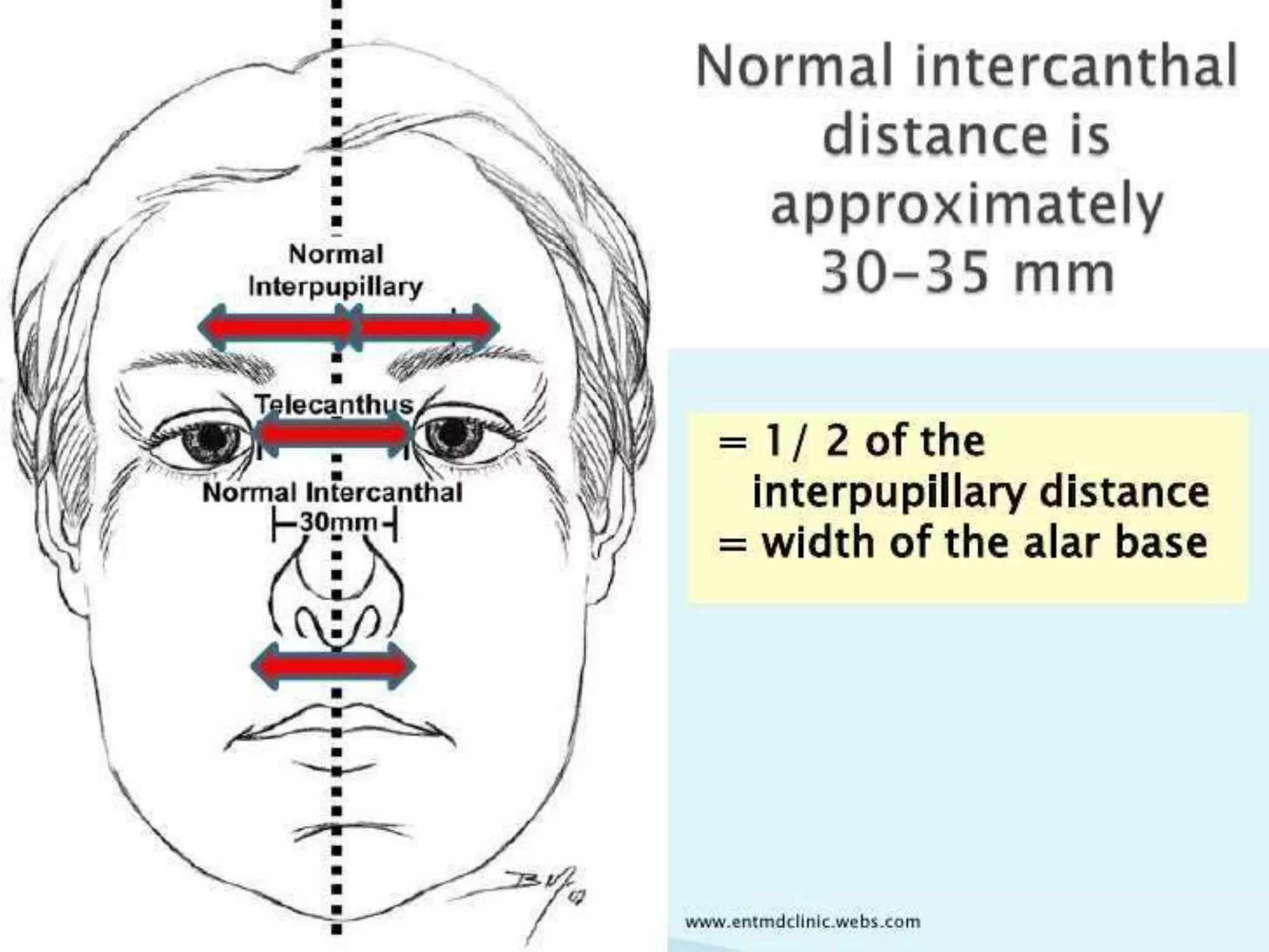 NOE FRACTURE PPT | PPTX