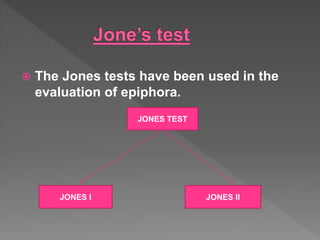  The Jones tests have been used in the
evaluation of epiphora.
JONES I JONES II
JONES TEST
 
