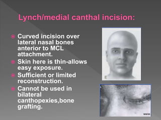  Curved incision over
lateral nasal bones
anterior to MCL
attachment.
 Skin here is thin-allows
easy exposure.
 Sufficient or limited
reconstruction.
 Cannot be used in
bilateral
canthopexies,bone
grafting.
 