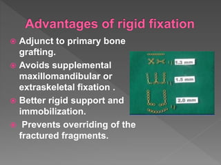  Adjunct to primary bone
grafting.
 Avoids supplemental
maxillomandibular or
extraskeletal fixation .
 Better rigid support and
immobilization.
 Prevents overriding of the
fractured fragments.
 