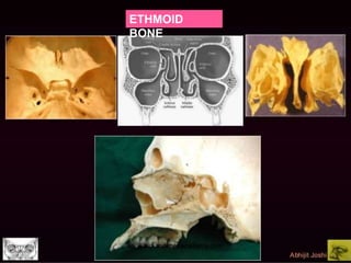 ETHMOID
BONE
 
