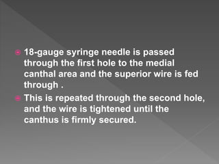  18-gauge syringe needle is passed
through the first hole to the medial
canthal area and the superior wire is fed
through .
 This is repeated through the second hole,
and the wire is tightened until the
canthus is firmly secured.
 