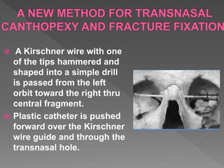  A Kirschner wire with one
of the tips hammered and
shaped into a simple drill
is passed from the left
orbit toward the right thru
central fragment.
 Plastic catheter is pushed
forward over the Kirschner
wire guide and through the
transnasal hole.
 