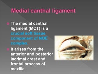  The medial canthal
ligament (MCT) is a
crucial soft tissue
component of NOE
complex.
 It arises from the
anterior and posterior
lacrimal crest and
frontal process of
maxilla.
 