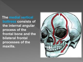 The medial vertical
buttress consists of
the internal angular
process of the
frontal bone and the
bilateral frontal
processes of the
maxilla.
 