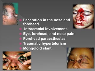  Laceration in the nose and
forehead.
 Intracranial involvement.
 Eye, forehead, and nose pain
 Forehead paraesthesias
 Traumatic hypertelorism
 Mongoloid slant.
 