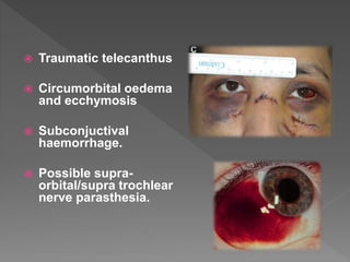 Traumatic telecanthus
 Circumorbital oedema
and ecchymosis
 Subconjuctival
haemorrhage.
 Possible supra-
orbital/supra trochlear
nerve parasthesia.
 
