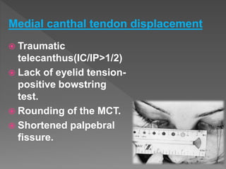  Traumatic
telecanthus(IC/IP>1/2)
 Lack of eyelid tension-
positive bowstring
test.
 Rounding of the MCT.
 Shortened palpebral
fissure.
Medial canthal tendon displacement
 