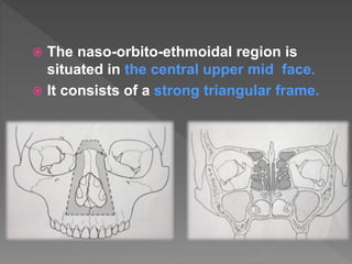 The naso-orbito-ethmoidal region is
situated in the central upper mid face.
 It consists of a strong triangular frame.
 