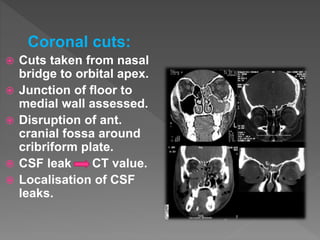 Coronal cuts:
 Cuts taken from nasal
bridge to orbital apex.
 Junction of floor to
medial wall assessed.
 Disruption of ant.
cranial fossa around
cribriform plate.
 CSF leak CT value.
 Localisation of CSF
leaks.
 