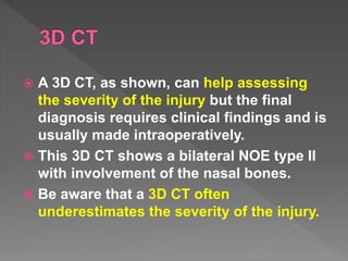  A 3D CT, as shown, can help assessing
the severity of the injury but the final
diagnosis requires clinical findings and is
usually made intraoperatively.
 This 3D CT shows a bilateral NOE type II
with involvement of the nasal bones.
 Be aware that a 3D CT often
underestimates the severity of the injury.
 