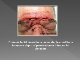 Examine facial lacerations under sterile conditions
to assess depth of penetration or intracranial
violation.
 