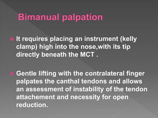  It requires placing an instrument (kelly
clamp) high into the nose,with its tip
directly beneath the MCT .
 Gentle lifting with the contralateral finger
palpates the canthal tendons and allows
an assessment of instability of the tendon
attachement and necessity for open
reduction.
 
