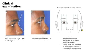 Evaluation of intercanthal distance
Clinical
examination
Ideal nasofrontal angle – 115
to 130 degrees
Ideal nasal projection is 1:1 • Average intercanthal
distance – 28 to 35mm
(differ with Race)
• Found to be half the value
of interpupillary distance
• Evaluate pre injury photos
 