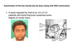 Examination of the Eye should also be done along with NOE examination
 A study reported by Holt et al, 67% of 727
patients with facial fractures sustained some
degree of ocular injury
 
