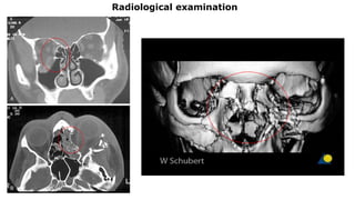 Radiological examination
 