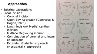 Approaches
• Existing Lacerations
• Local incision
• Coronal incision
• Open Sky Approach (Converse &
Hogan,1970)
• Lynch incision/ Medial canthal
incision
• Midface Degloving incision
• Combination of coronal and lower
lid incisions
• Extended Glabellar approach
(Horizontal Y approach)
 