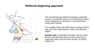 Midfacial degloving approach
The horseshoe type bilateral maxillary vestibular
incision is combined with a circumferential incision
(intercartilaginous, transfixion, and nasal floor)
inside both nostrils.
This enables lifting the soft-tissue envelope all the
way up to the nasal dorsum, radix and ethmoid
region.
Access area is extended cranially into the nasal
dorsum and ethmoid area as well as the entire
zygomatic body and the lower portion of lateral
orbital rim
 
