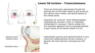 Lower lid incision - Transcutaneous
There are three basic approaches through the
external skin of the lower eyelid to give access to
the inferior, lower medial, and lateral aspects of
the orbital cavity:
•Subciliary (A, synonym: lower blepharoplasty)
•Subtarsal (B, synonym: lower or mideyelid)
•Infraorbital (C, synonym: inferior orbital rim)
The subciliary approach can be extended laterally
to gain access to the lateral orbital rim (D).
Hypertrophic scarring and keloid formation is very
uncommon following lower lid skin incisions. In
general, the scars become inconspicuous with
time.
 