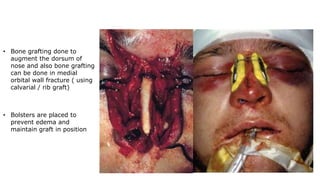 • Bone grafting done to
augment the dorsum of
nose and also bone grafting
can be done in medial
orbital wall fracture ( using
calvarial / rib graft)
• Bolsters are placed to
prevent edema and
maintain graft in position
 