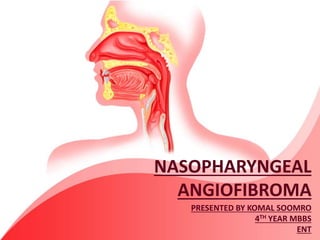 NASOPHARYNGEAL
ANGIOFIBROMA
PRESENTED BY KOMAL SOOMRO
4TH YEAR MBBS
ENT
 