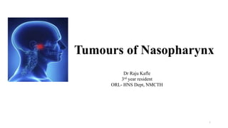 Tumours of Nasopharynx
Dr Raju Kafle
3rd year resident
ORL- HNS Dept, NMCTH
1
 