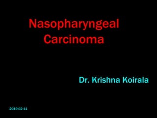 Nasopharyngeal
Carcinoma
Dr. Krishna Koirala
2019-02-11
 
