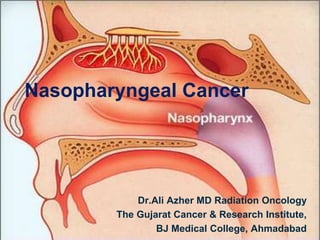 Nasopharyngeal Cancer
Dr.Ali Azher MD Radiation Oncology
The Gujarat Cancer & Research Institute,
BJ Medical College, Ahmadabad
 