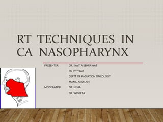 RT TECHNIQUES IN
CA NASOPHARYNX
PRESENTER: DR. KAVITA SEHRAWAT
PG 3RD YEAR
DEPTT OF RADIATION ONCOLOGY
MAMC AND LNH
MODERATOR: DR. NEHA
DR. WINEETA
 