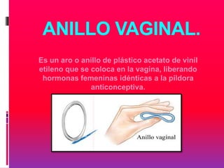 ANILLO VAGINAL.
Es un aro o anillo de plástico acetato de vinil
etileno que se coloca en la vagina, liberando
hormonas femeninas idénticas a la píldora
anticonceptiva.
 