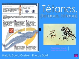 Tétanos. (tetanus, tétano) Natalia Souto Castelo . Enero / 2oo9 Clostridium Tetani . (agente causante) 