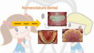 PalatinoLingualVestibular
 