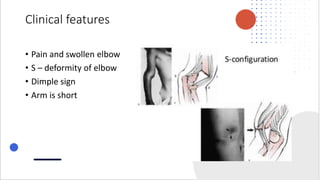 Upper extremity fractures.pptx | Death, Injury, or Military Conflict ...