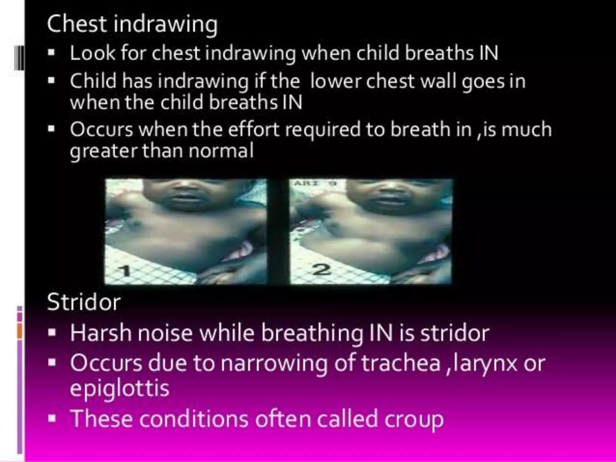 National ARI control program