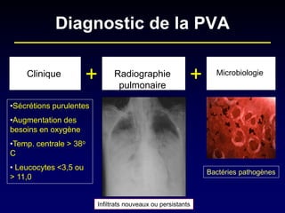 Diagnostic de la PVA 
Clinique 
+ 
Microbiologie 
• 
Sécrétions purulentes 
• 
Augmentation des besoins en oxygène 
• 
Temp. centrale > 38o C 
• 
Leucocytes <3,5 ou > 11,0 
+ 
Radiographie pulmonaire 
Bactéries pathogènes 
Infiltrats nouveaux ou persistants  