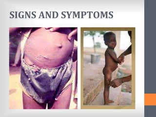 SIGNS AND SYMPTOMS
 