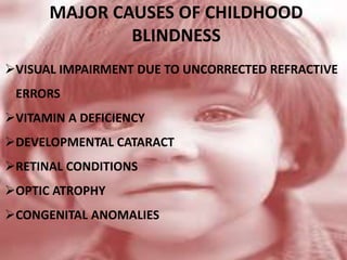 MAJOR CAUSES OF CHILDHOOD
BLINDNESS
VISUAL IMPAIRMENT DUE TO UNCORRECTED REFRACTIVE
ERRORS
VITAMIN A DEFICIENCY
DEVELOPMENTAL CATARACT
RETINAL CONDITIONS
OPTIC ATROPHY
CONGENITAL ANOMALIES
 