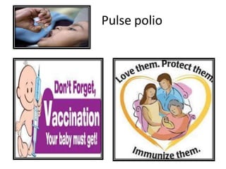 Pulse polio
 