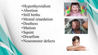 •Hyperthyroidism
•Abortion
•Still births
•Mental retardation
•Deafness
•Mutism
•Squint
•Dwarfism
•Neuromotor defects
 
