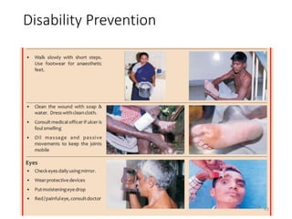 Disability Prevention
43
 