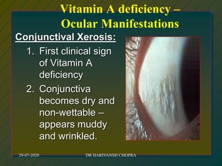 Conjunctival Xerosis:
1. First clinical sign
of Vitamin A
deficiency
2. Conjunctiva
becomes dry and
non-wettable –
appears muddy
and wrinkled.
Vitamin A deficiency –
Ocular Manifestations
29-07-2020 DR HARIVANSH CHOPRA
 