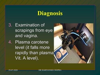Diagnosis
3. Examination of
scrapings from eye
and vagina.
4. Plasma carotene
level (it falls more
rapidly than plasma
Vit. A level).
29-07-2020 DR HARIVANSH CHOPRA
 